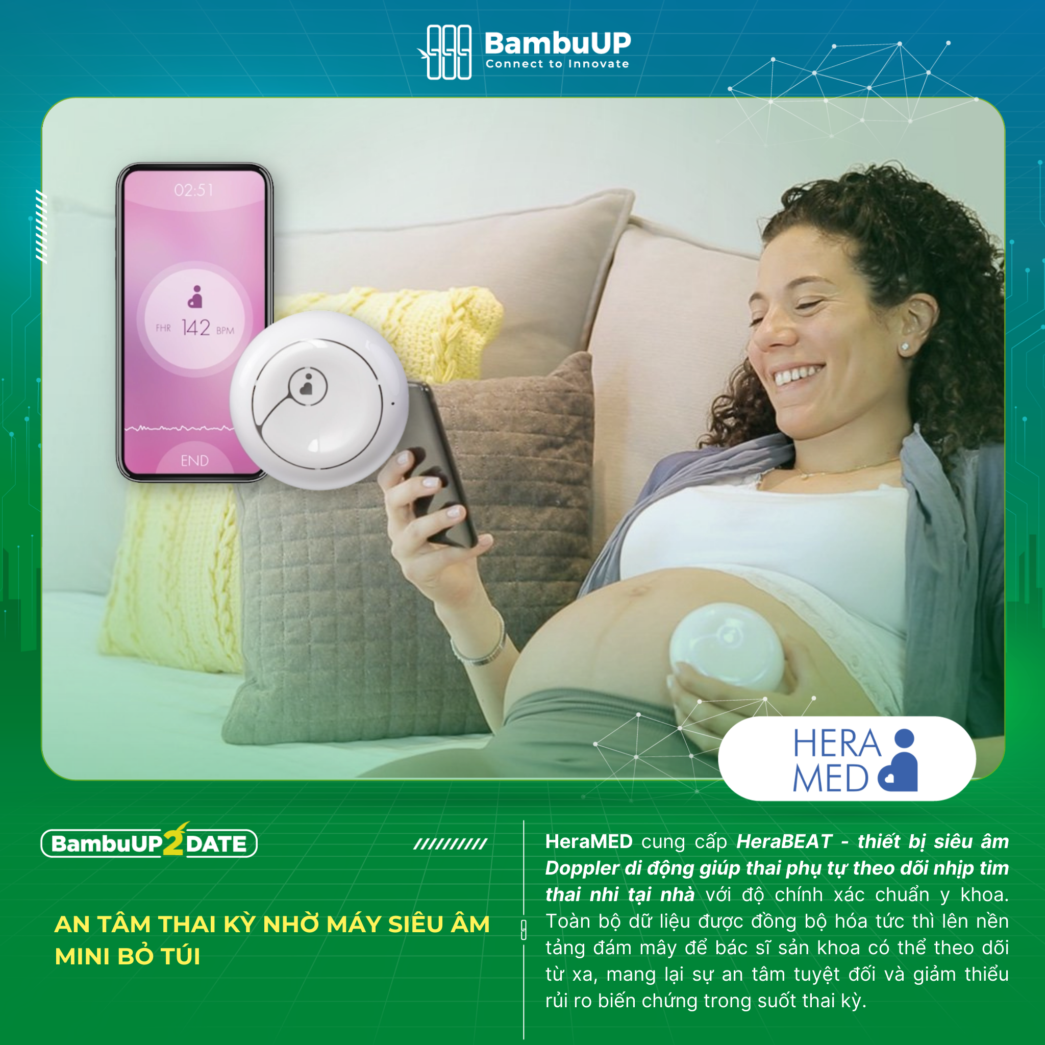 Máy siêu âm mini bỏ túi cho mẹ bầu